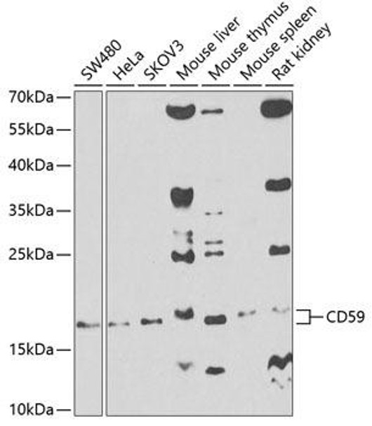 Cell Biology Antibodies 7 Anti-CD59 Antibody CAB1689
