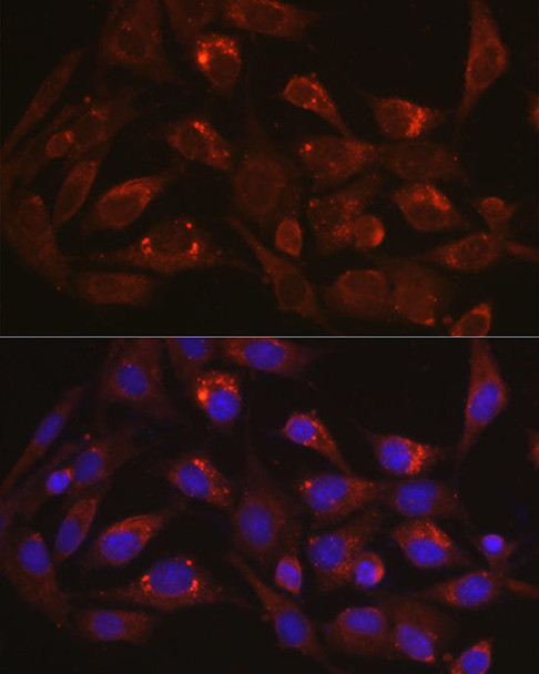 Immunology Antibodies 2 Anti-LAMP1 Antibody CAB16894