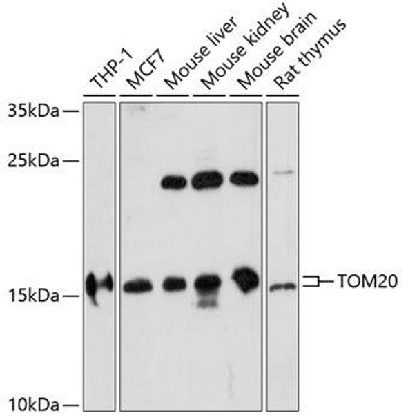 Cell Biology Antibodies 7 Anti-TOM20 Antibody CAB16896