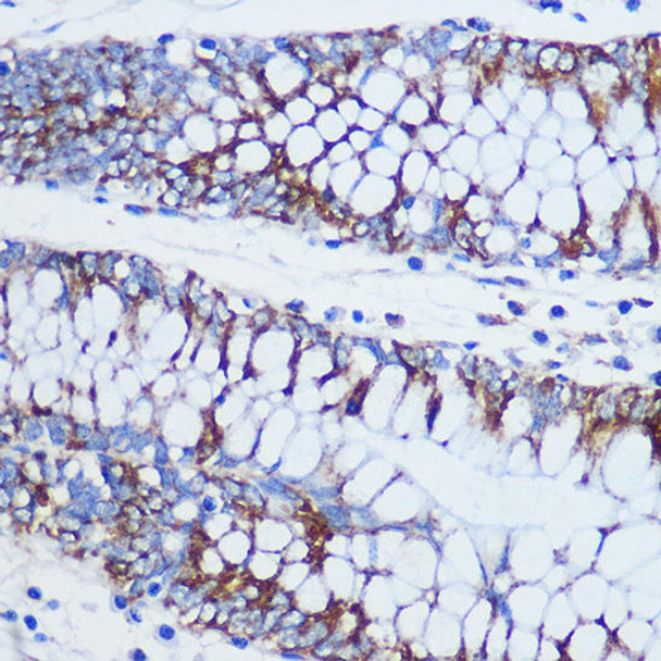 Cell Biology Antibodies 7 Anti-TOM20 Antibody CAB16896