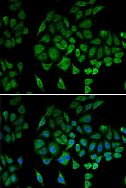 Cell Biology Antibodies 7 Anti-NDUFS1 Antibody CAB16926