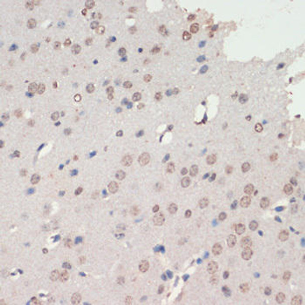 Developmental Biology Anti-NEUROD1 Antibody CAB16927