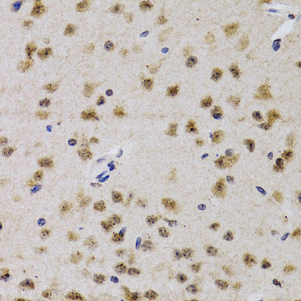 Cell Cycle Antibodies 1 Anti-CDK7 Antibody CAB1694