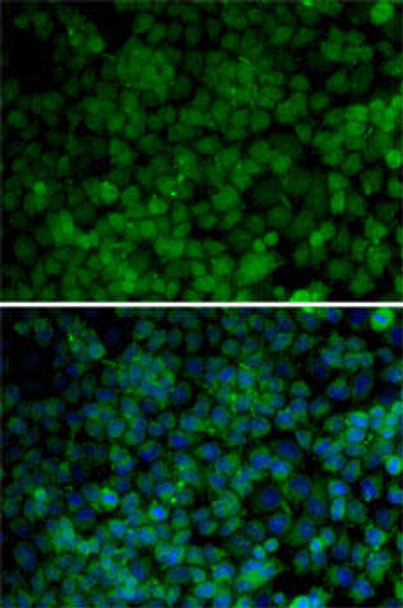 Cell Cycle Antibodies 1 Anti-CDK7 Antibody CAB1694