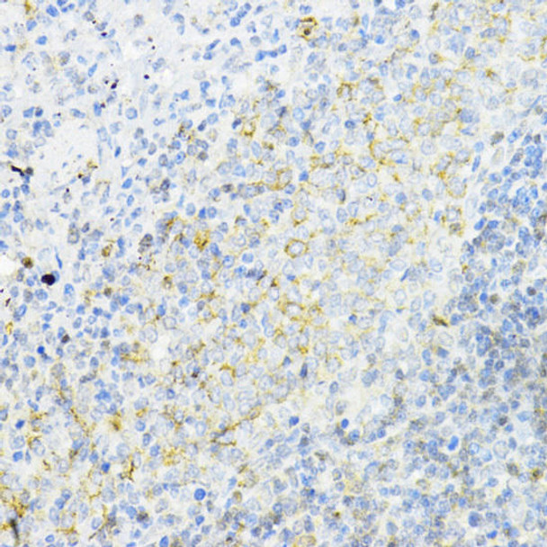 Autophagy Antibodies Anti-AMPKAlpha1 Antibody CAB16960