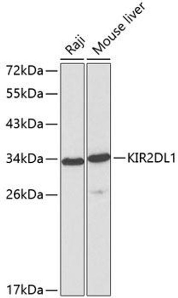 Cell Biology Antibodies 7 Anti-KIR2DL1 Antibody CAB1697