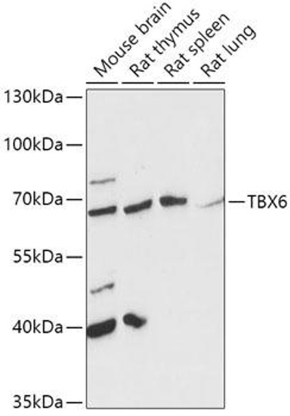 Epigenetics and Nuclear Signaling Antibodies 3 Anti-TBX6 Antibody CAB16979