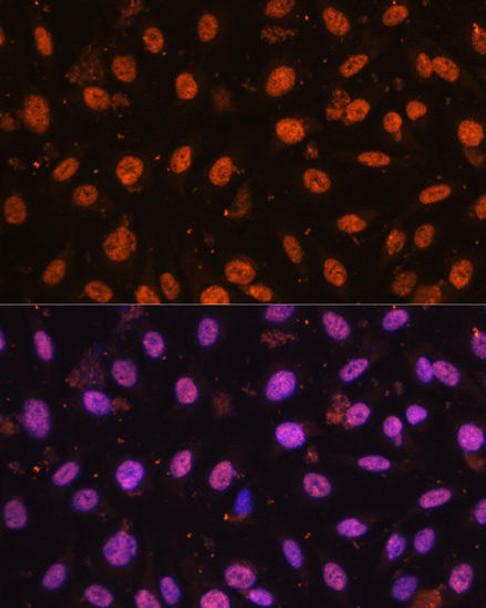 Developmental Biology Anti-ZEB1 Antibody CAB16981