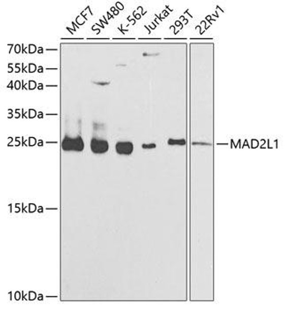 Cell Cycle Antibodies 1 Anti-MAD2L1 Antibody CAB1699