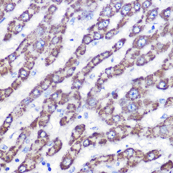 Signal Transduction Antibodies 2 Anti-UCP3 Antibody CAB16995