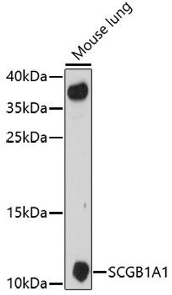 Cell Biology Antibodies 7 Anti-SCGB1A1 Antibody CAB16997