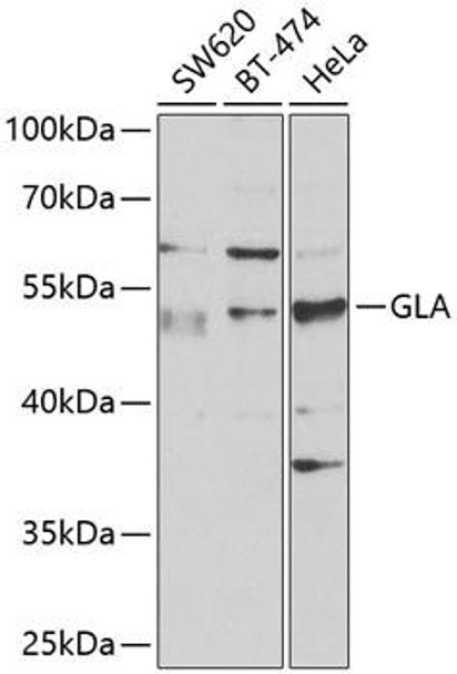 Cell Biology Antibodies 7 Anti-GLA Antibody CAB1700