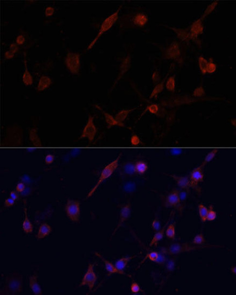 Cell Biology Antibodies 7 Anti-CFL1 Antibody CAB1704