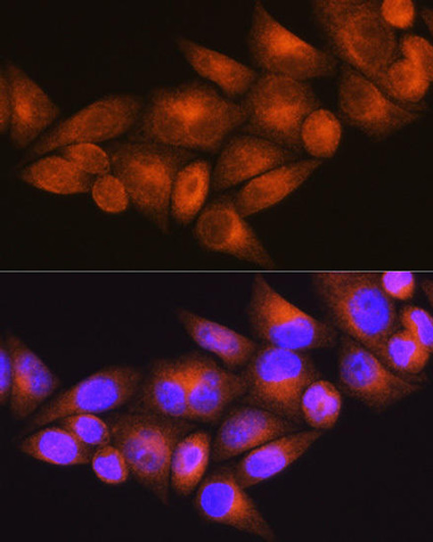 Cell Biology Antibodies 7 Anti-WFS1 Antibody CAB1705