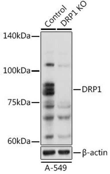 KO Validated Antibodies 1 Anti-DRP1 Antibody CAB17069KO Validated