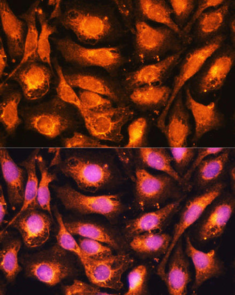 KO Validated Antibodies 1 Anti-DRP1 Antibody CAB17069KO Validated