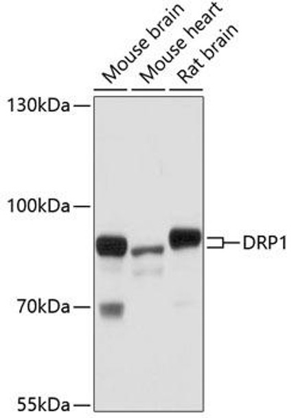 KO Validated Antibodies 1 Anti-DRP1 Antibody CAB17069KO Validated