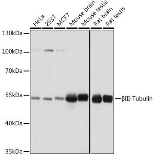 KO Validated Antibodies 1 Anti-BetaIII-Tubulin Antibody CAB17074KO Validated
