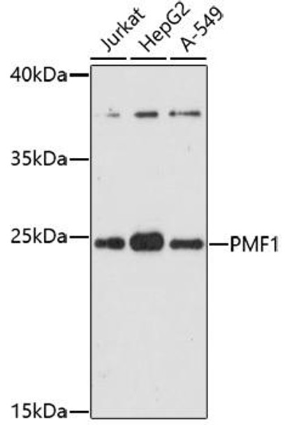 Cell Cycle Antibodies 1 Anti-PMF1 Antibody CAB17095