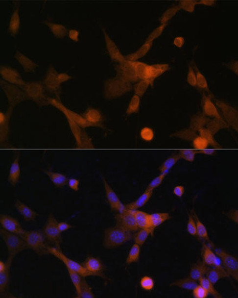 Cell Biology Antibodies 7 Anti-BBC3 Antibody CAB17138