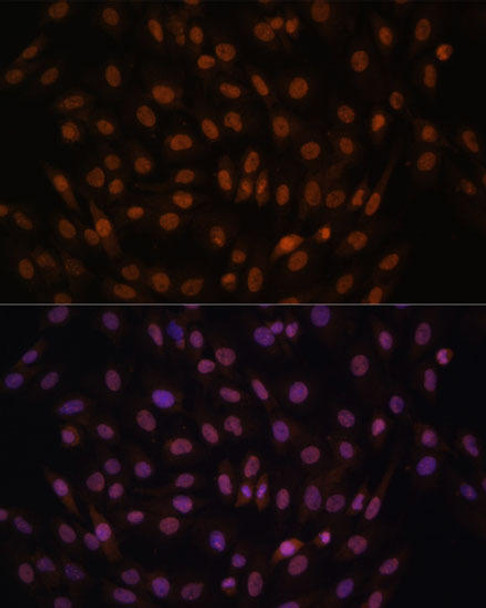 Cell Biology Antibodies 7 Anti-FCF1 Antibody CAB17149