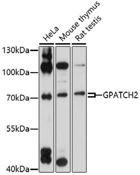 Cell Biology Antibodies 7 Anti-GPATCH2 Antibody CAB17175