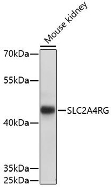 Epigenetics and Nuclear Signaling Antibodies 3 Anti-SLC2A4RG Antibody CAB17187