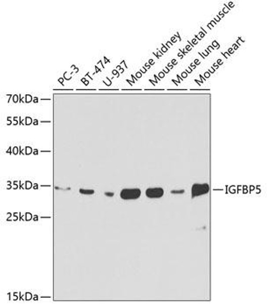 Cell Biology Antibodies 7 Anti-IGFBP5 Antibody CAB1720