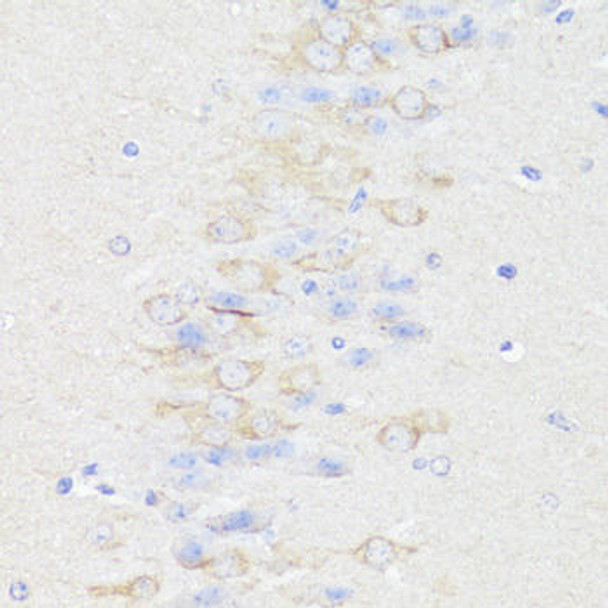 Cell Biology Antibodies 7 Anti-B7-H3/CD276 Antibody CAB17216