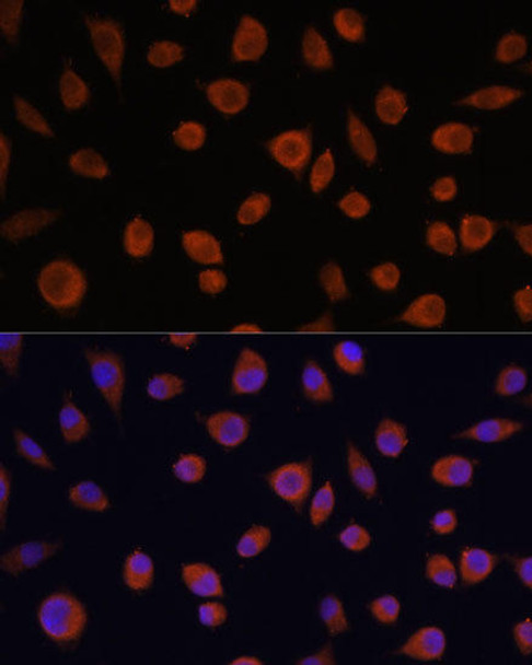 Immunology Antibodies 2 Anti-ZCCHC3 Antibody CAB17235