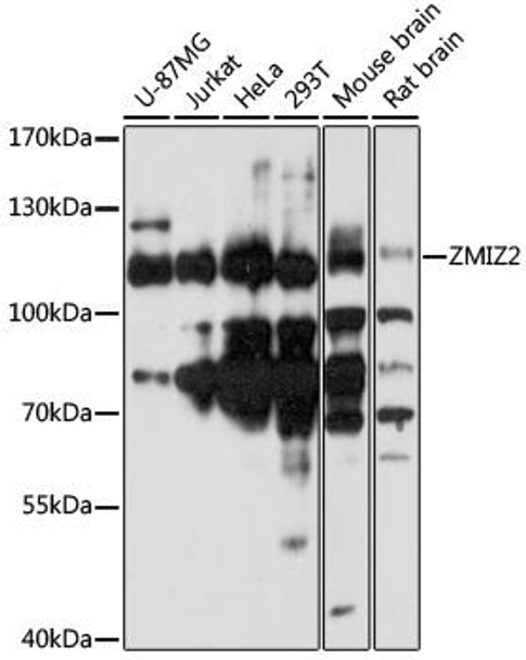 Epigenetics and Nuclear Signaling Antibodies 3 Anti-ZMIZ2 Antibody CAB17301