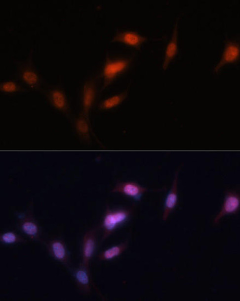 KO Validated Antibodies 1 Anti-SIRT1 Antibody CAB17307KO Validated