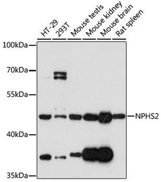 Cell Biology Antibodies 7 Anti-NPHS2 Antibody CAB17337