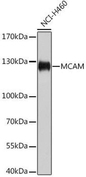 Cell Biology Antibodies 7 Anti-MCAM Antibody CAB17347