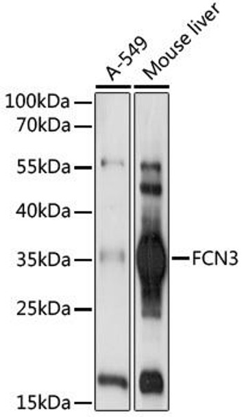 Immunology Antibodies 2 Anti-FCN3 Antibody CAB17352