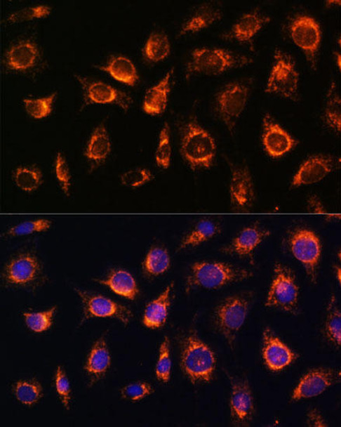 Autophagy Antibodies Anti-RAB1A Antibody CAB17364