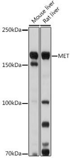 Cell Biology Antibodies 7 Anti-MET Antibody CAB17366