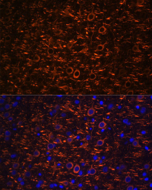 Cell Biology Antibodies 7 Anti-Map2 Antibody CAB17409