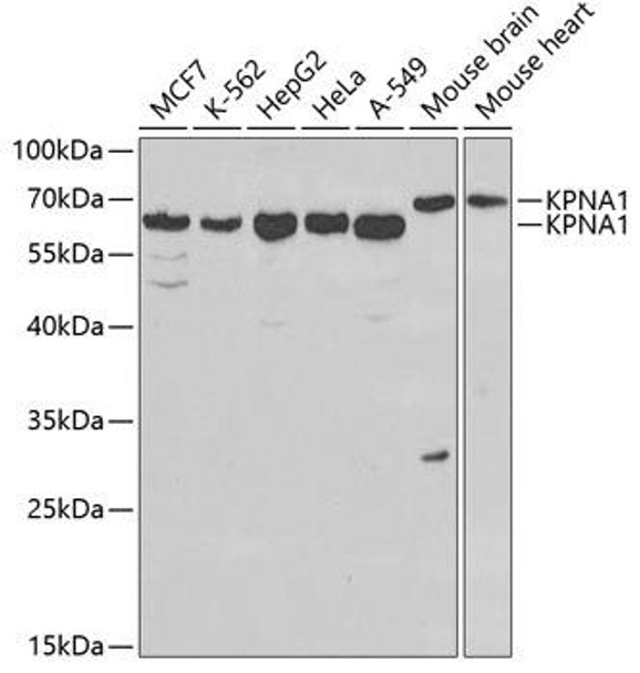 Immunology Antibodies 2 Anti-KPNA1 Antibody CAB1742