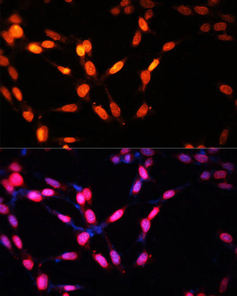 Cell Cycle Antibodies 1 Anti-MYOG Antibody CAB17427