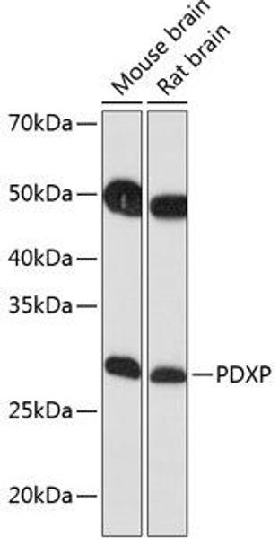 Cell Biology Antibodies 7 Anti-PDXP Antibody CAB17455