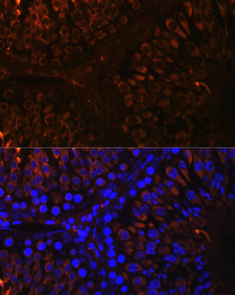 Neuroscience Anti-RTN4 Antibody CAB1752