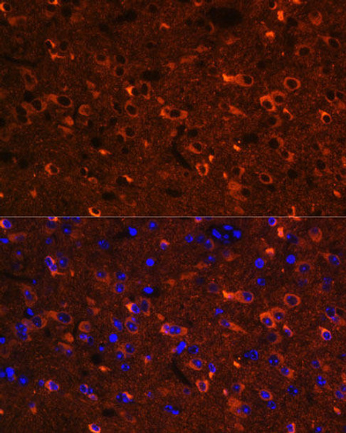 Neuroscience Anti-RTN4 Antibody CAB1752