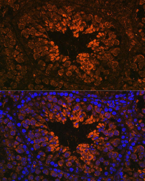 Neuroscience Anti-RTN4 Antibody CAB1752