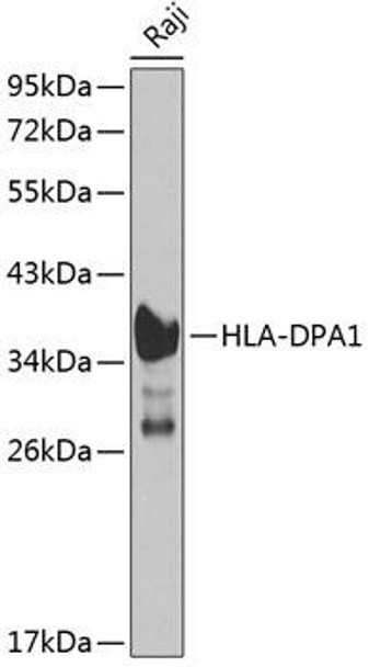 Immunology Antibodies 2 Anti-HLA-DPA1 Antibody CAB1754