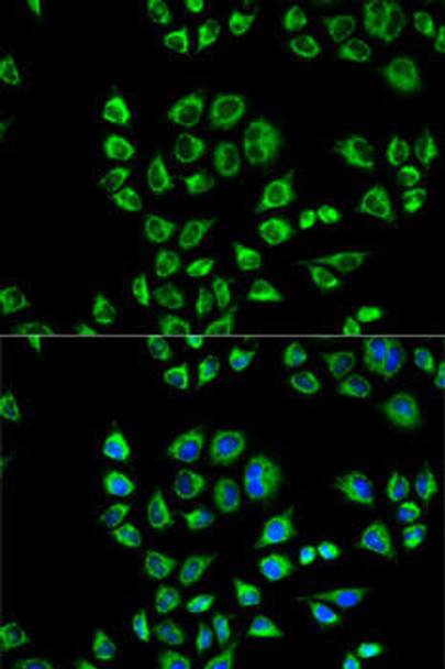 Immunology Antibodies 2 Anti-CD1D Antibody CAB1760