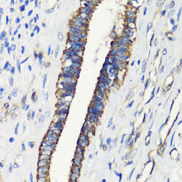 Cell Biology Antibodies 7 Anti-FKBP1A Antibody CAB1763