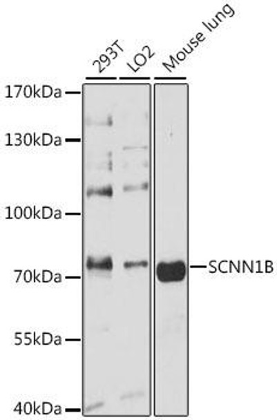 Signal Transduction Antibodies 2 Anti-SCNN1B Antibody CAB1765