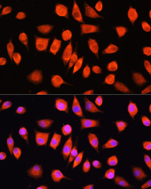 Cell Biology Antibodies 7 Anti-FTL Antibody CAB1768