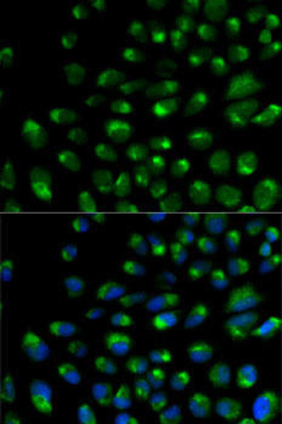 Cell Biology Antibodies 7 Anti-IFNAR2 Antibody CAB1769